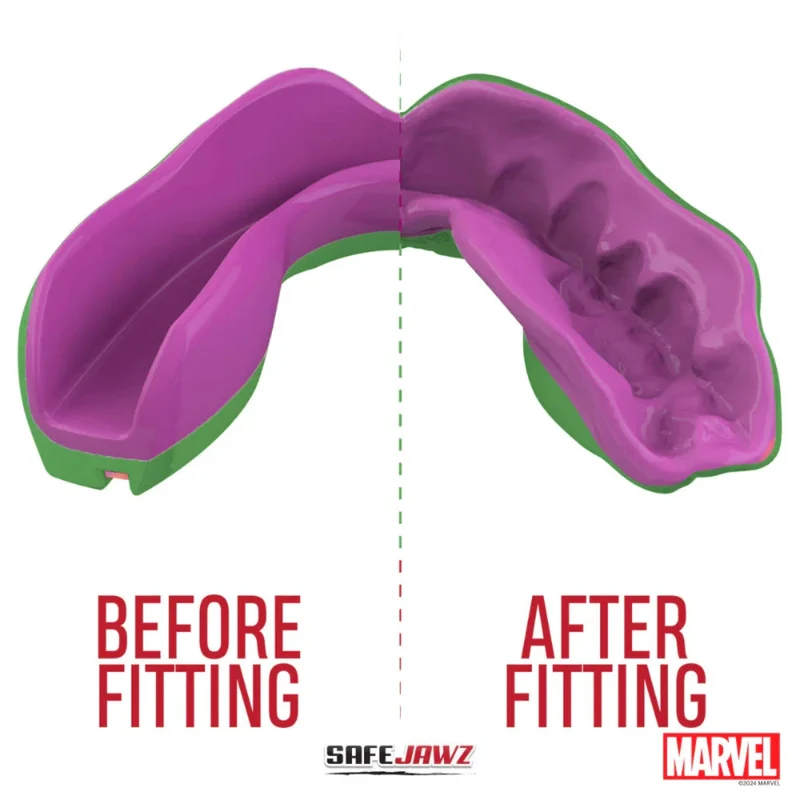 Safejawz Marvel The Hulk Gum Shield Youth